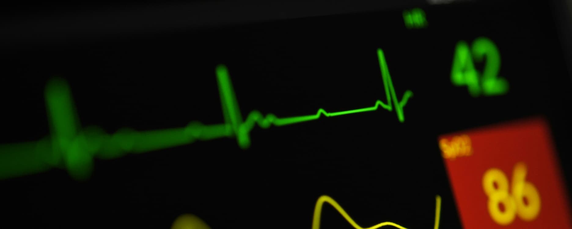 What Is a Cron Job? Our Beginner's Guide to Automating Server and App Tasks